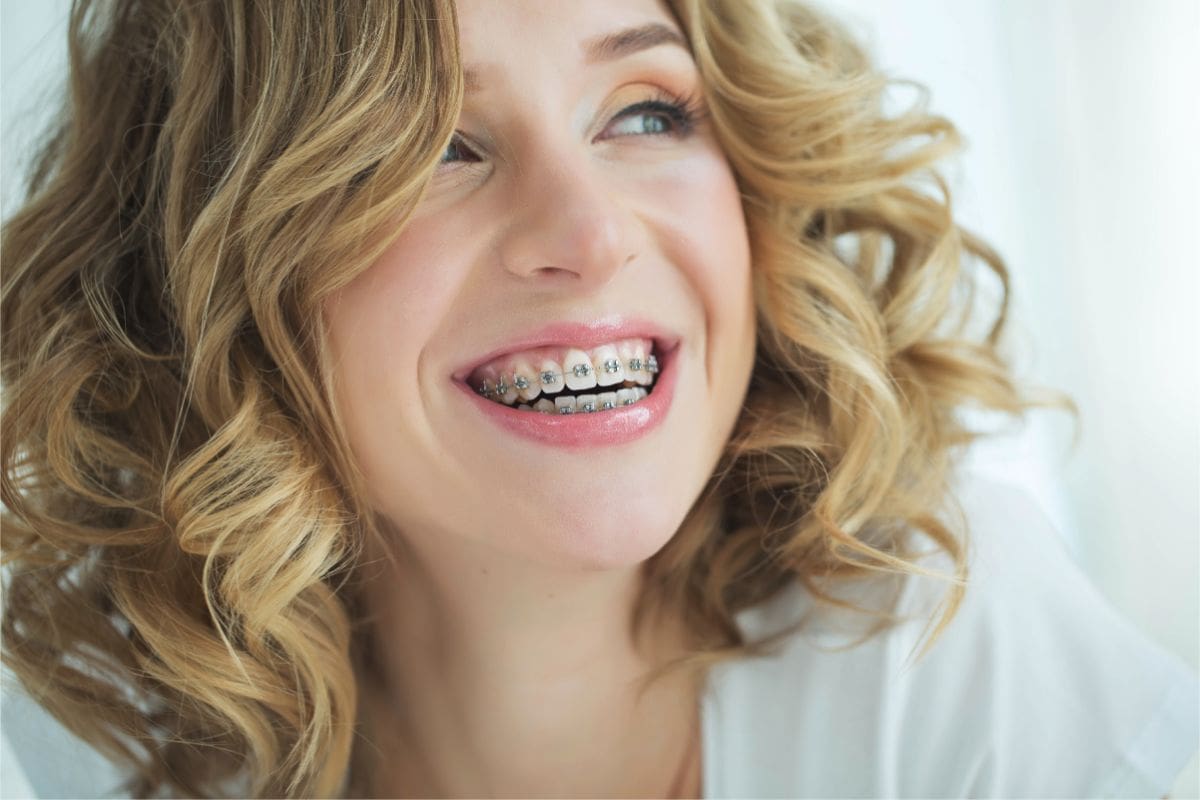 For Adult - Quarry Orthodontics in Baltimore, MD