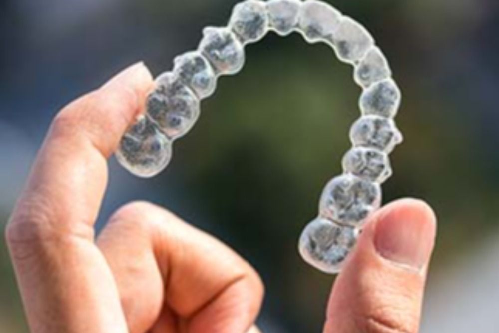 Treatment options for adults - Quarry Orthodontics in Baltimore, MD