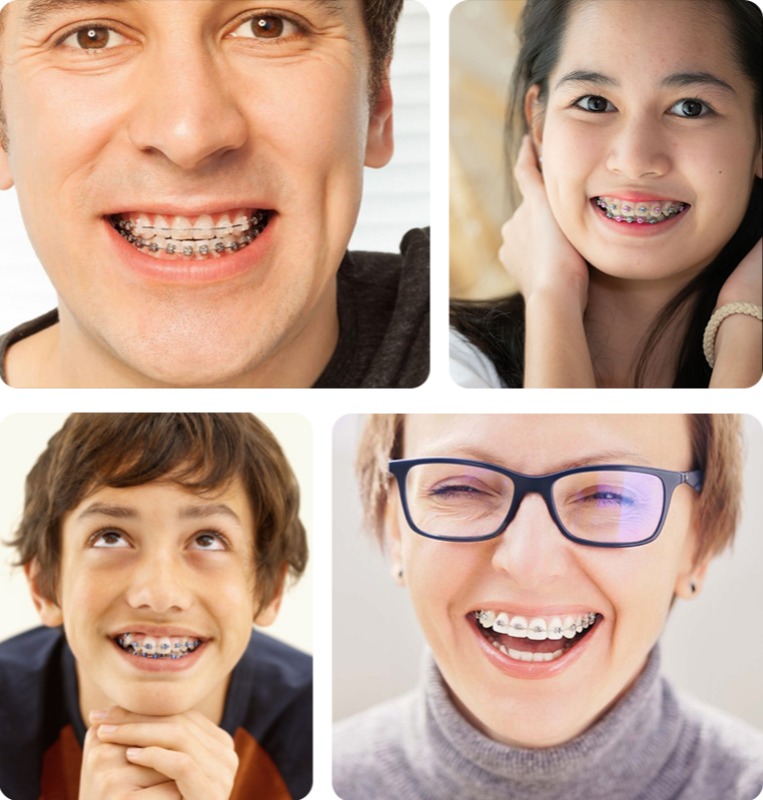 Why Braces - Quarry Orthodontics in Baltimore, MD