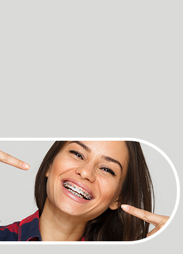 Damon® System - Quarry Orthodontics in Baltimore, MD