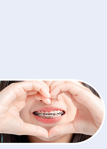 Life with Braces - Quarry Orthodontics in Baltimore, MD