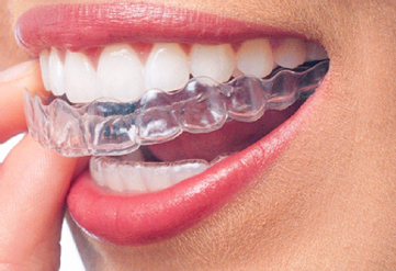 Invisalign Treatment - Quarry Orthodontics in Baltimore, MD