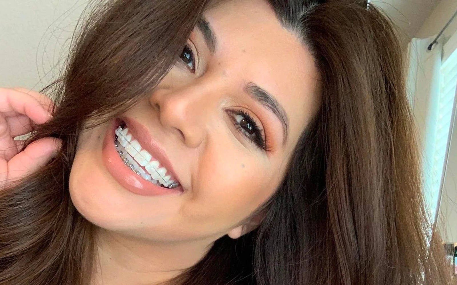 Damon® System - Quarry Orthodontics in Baltimore, MD