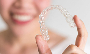 Palatal Expander - Quarry Orthodontics in Baltimore, MD