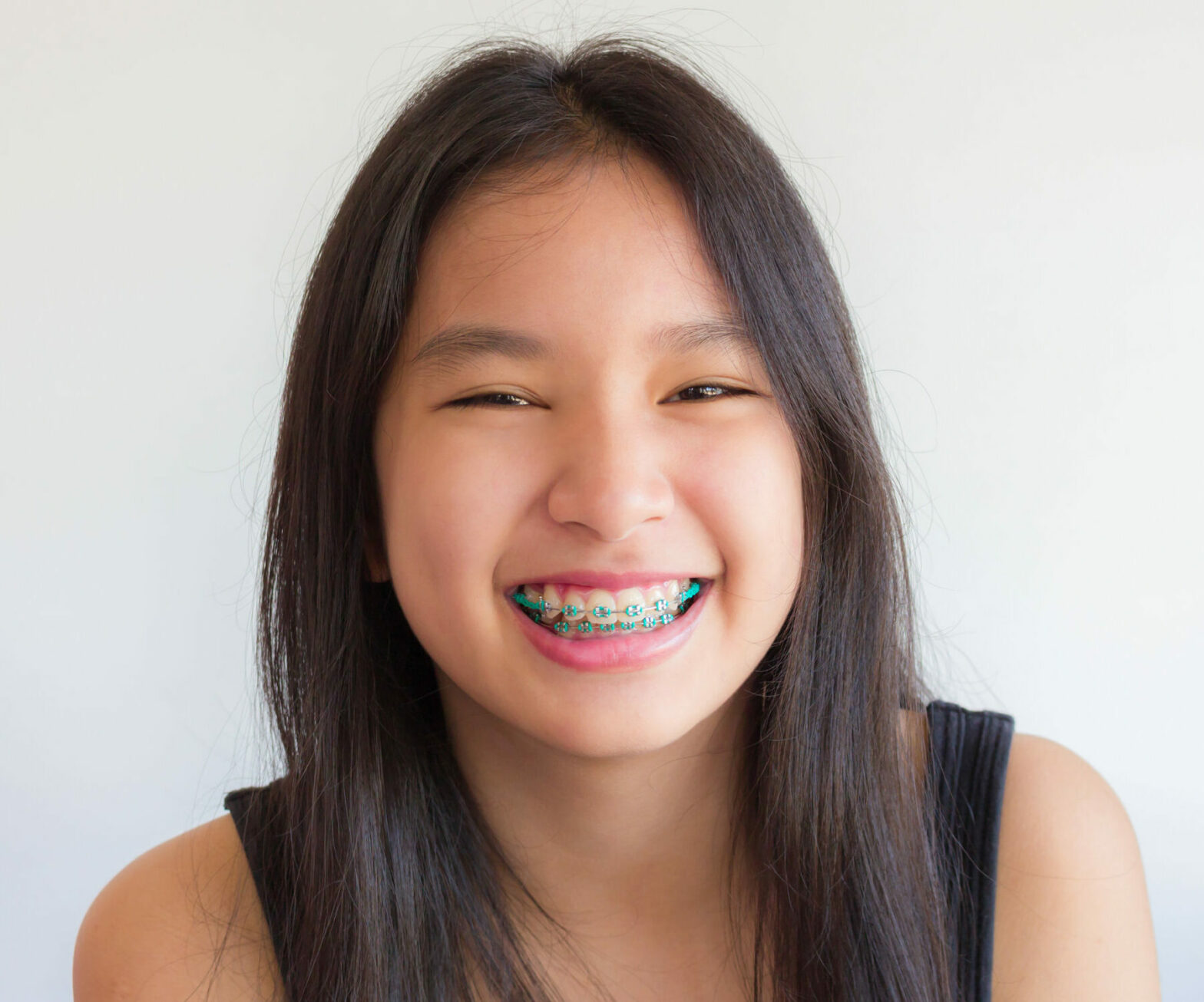 Eating with braces: - Quarry Orthodontics in Baltimore, MD