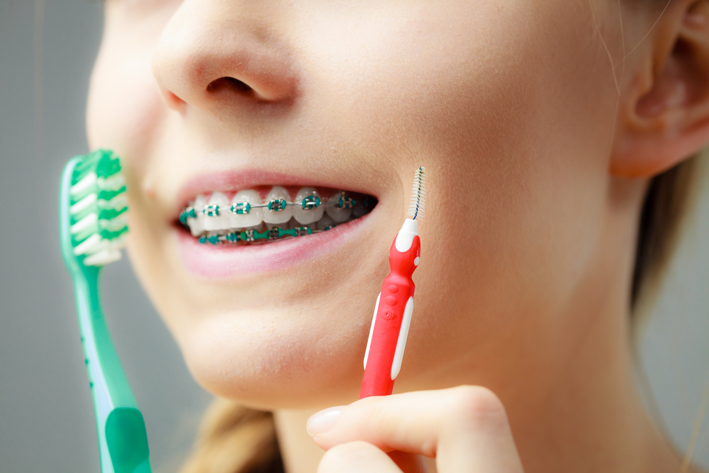 Why should you consider orthodontic treatment? - Quarry Orthodontics in Baltimore, MD