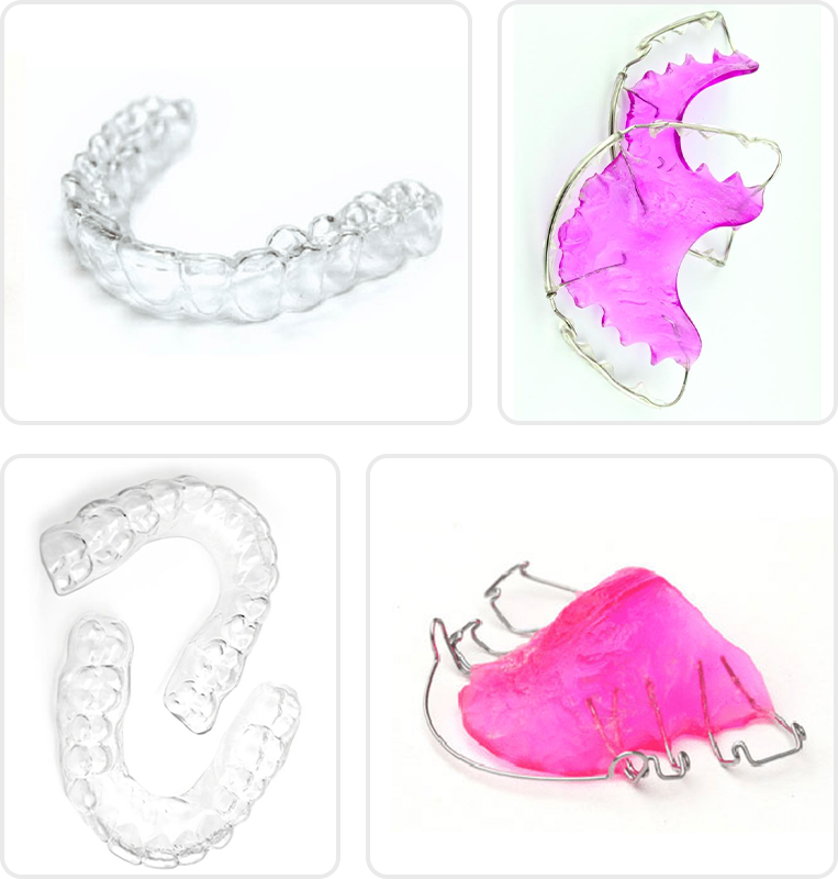 Retainer Instructions - Quarry Orthodontics in Baltimore, MD